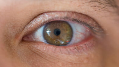 Eyes