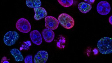 national cancer institute L7en7Lb Ovc unsplash1